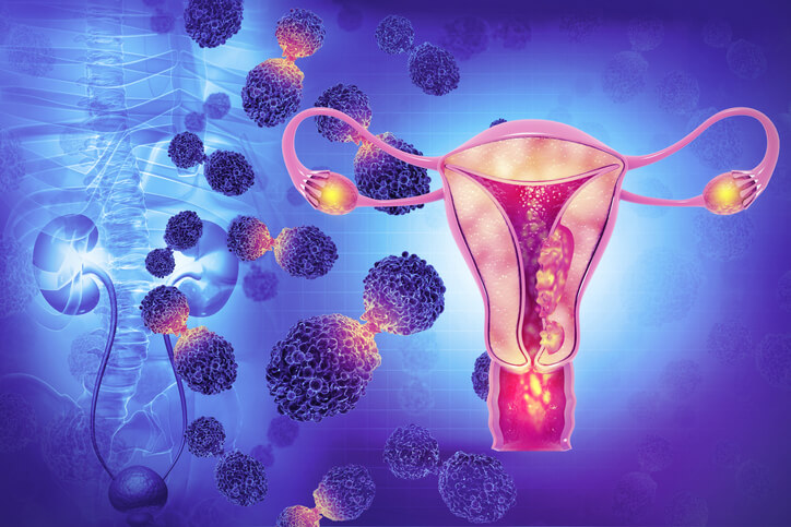 Prevenzione Oncologica – Displasia – CIN