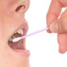 La prevenzione della trombofilia